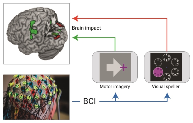 Brain-computer interface could be tailored to treat brain disorders