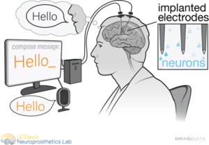 UCD Neuroprosthetics Lab Junior Software Engineer Position Job Image